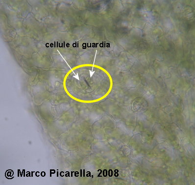 Stoma